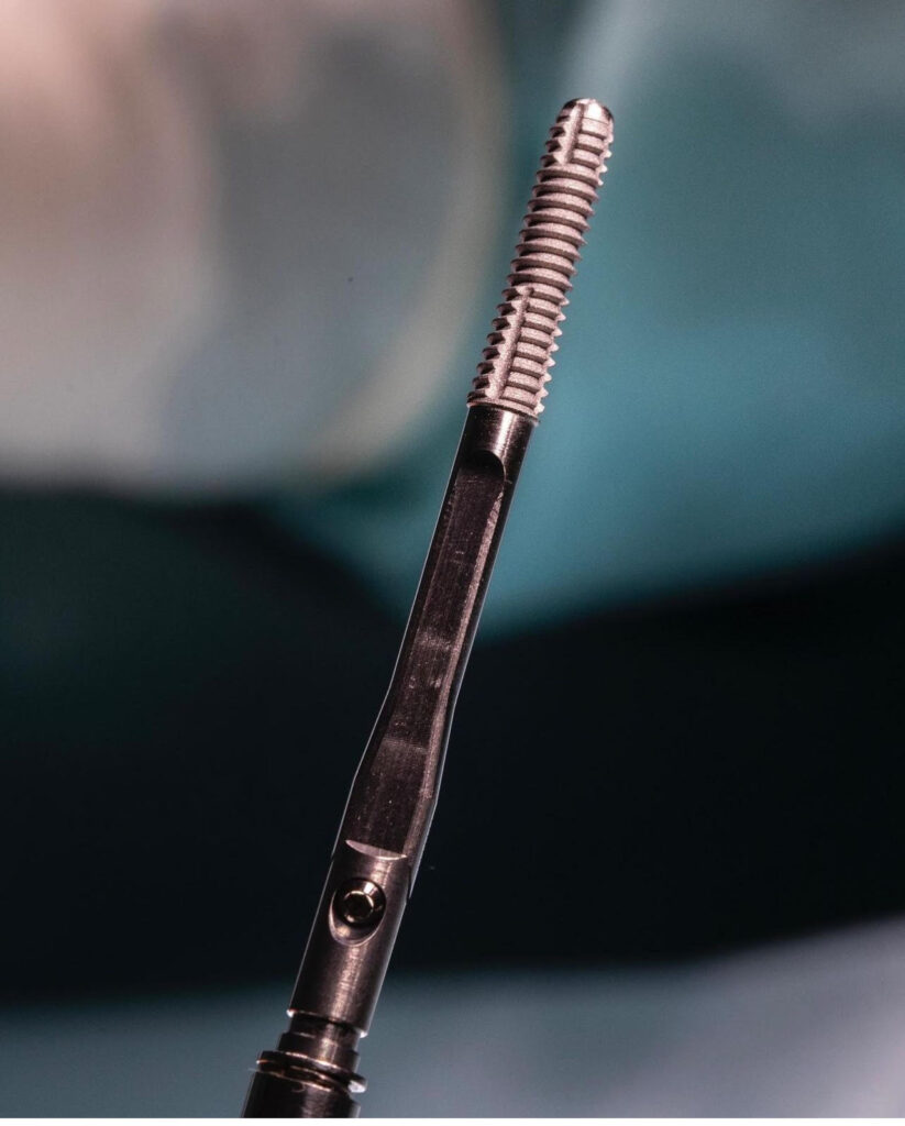 implantes cigomaticos en madrid